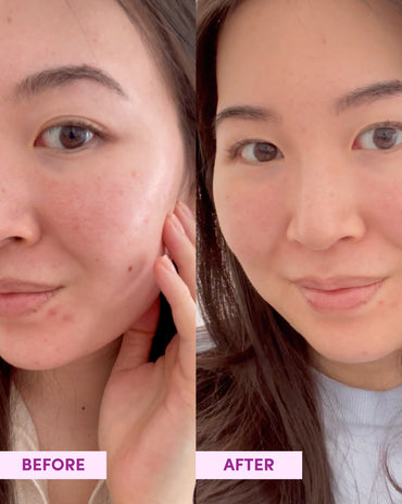 Australian Glow Berries Super Bounce Mask