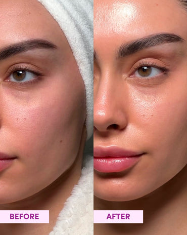 Australian Glow Berries Dreamy Glow Drops