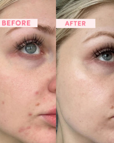 Australian Pink Clay Resurfacing Mask