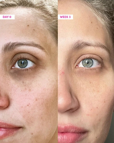 Anti-aging Eye Cream